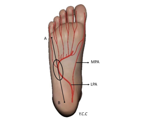 the-lateral-plantar-artery-as-recipient-vessel-for-microsurgical